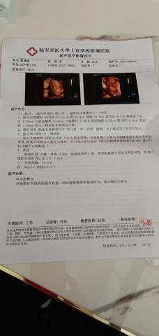 journal_insert_pic_1676078553