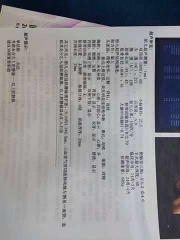 journal_insert_pic_1679866899