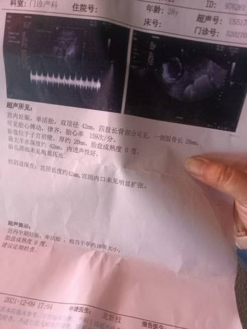 journal_insert_pic_1677215524