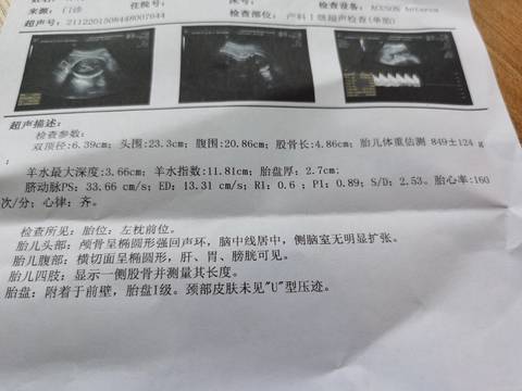 journal_insert_pic_1683156364