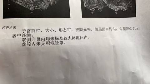 journal_insert_pic_1678125207