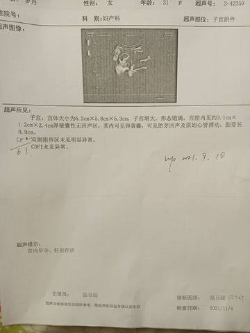 journal_insert_pic_1674196673