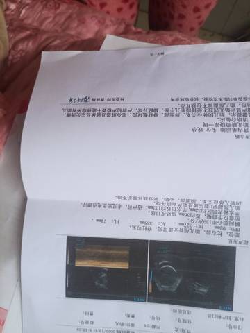 journal_insert_pic_1675959129