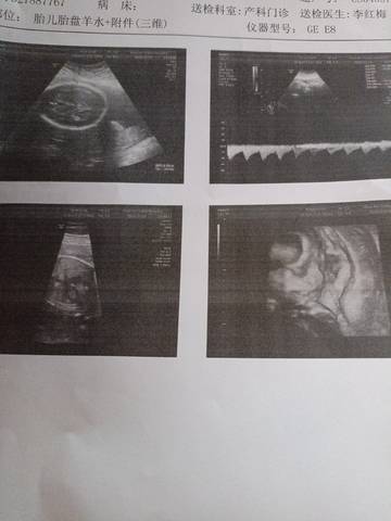 journal_insert_pic_1679425938