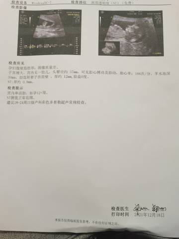 journal_insert_pic_1682147392