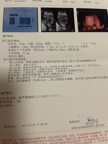 journal_insert_pic_1686826942