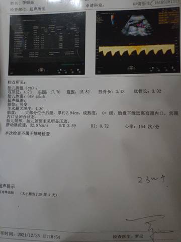 journal_insert_pic_1686194575