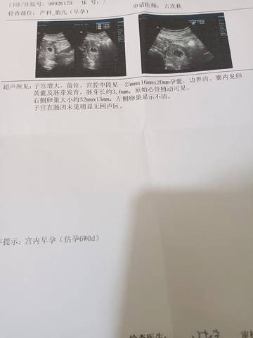 journal_insert_pic_1719410552