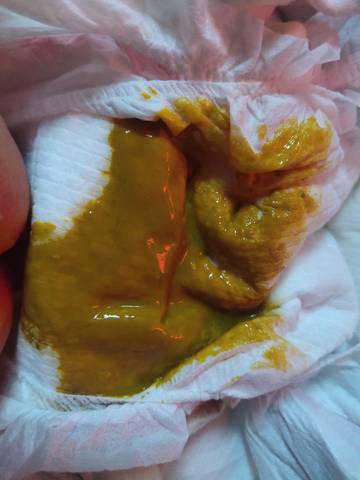 journal_insert_pic_1719678335