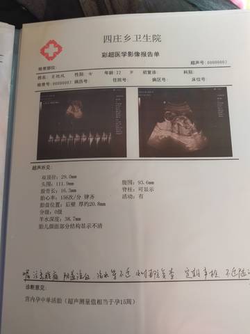 journal_insert_pic_1684599176