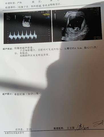 journal_insert_pic_1674840306
