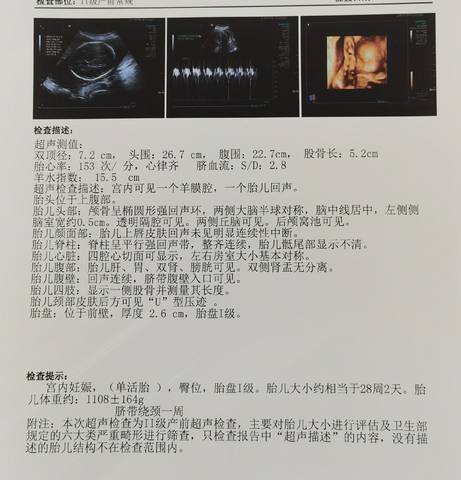 journal_insert_pic_1680985213