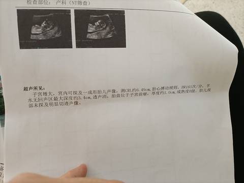 journal_insert_pic_1676807951