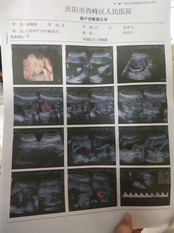 journal_insert_pic_1682170788
