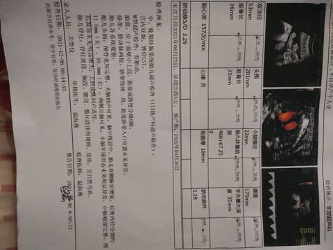 journal_insert_pic_1675452202