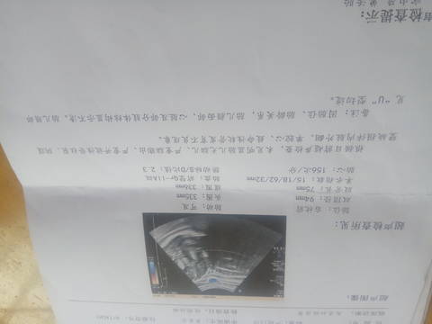journal_insert_pic_1675904983