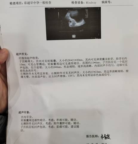 journal_insert_pic_1673536374