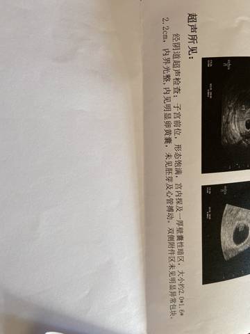 journal_insert_pic_1674751280