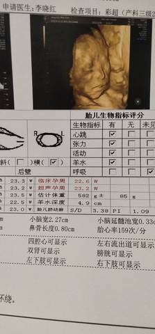 journal_insert_pic_1682213686