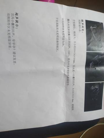 journal_insert_pic_1678501057