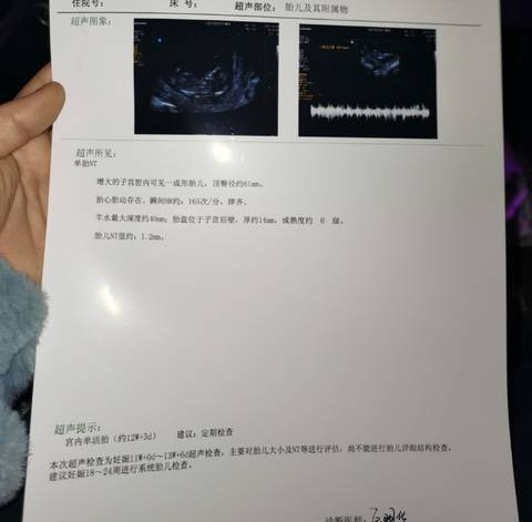 journal_insert_pic_1684032534