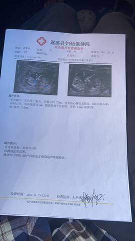journal_insert_pic_1675121819