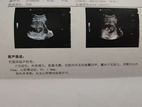 journal_insert_pic_1684589823