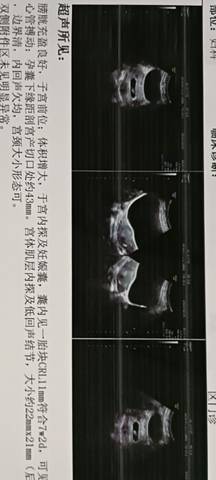 journal_insert_pic_1679820160