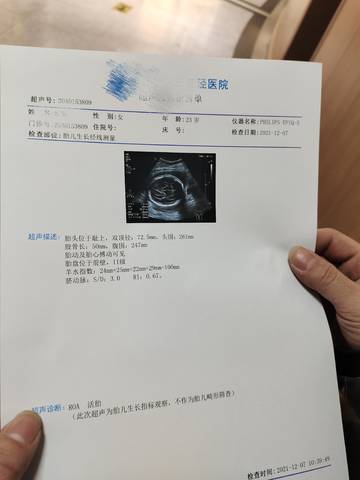 journal_insert_pic_1676016551