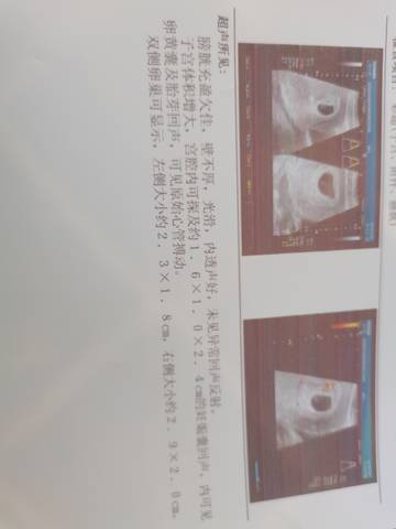 journal_insert_pic_1683078936