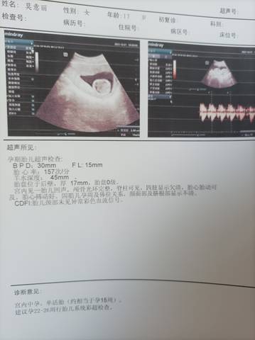 journal_insert_pic_1677449467