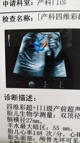 journal_insert_pic_1684594045