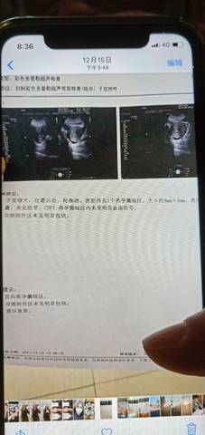 journal_insert_pic_1689142656