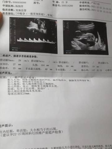 journal_insert_pic_1685934953