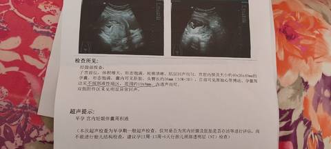 journal_insert_pic_1682425558