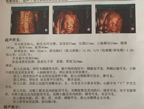journal_insert_pic_1682115643