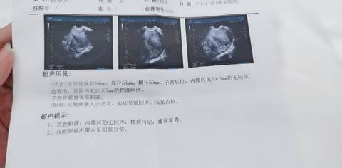 journal_insert_pic_1677582222