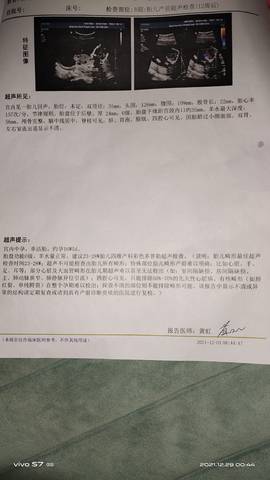 journal_insert_pic_1688080434