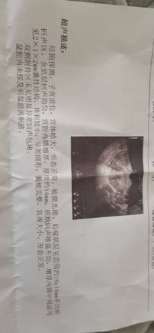 journal_insert_pic_1681922241