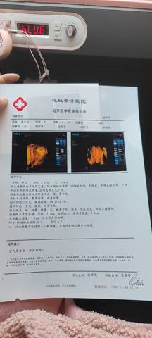 journal_insert_pic_1673909854