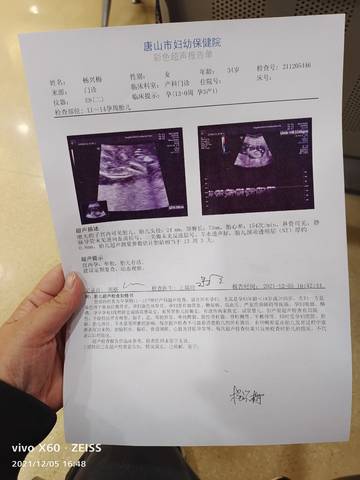 journal_insert_pic_1674213932