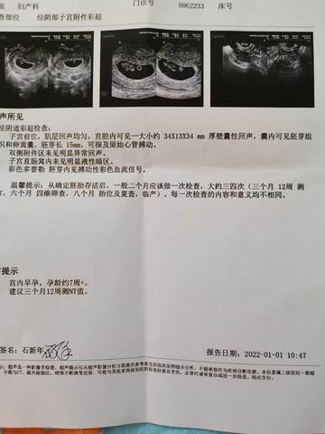 journal_insert_pic_1690523188