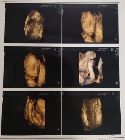 journal_insert_pic_1689838509