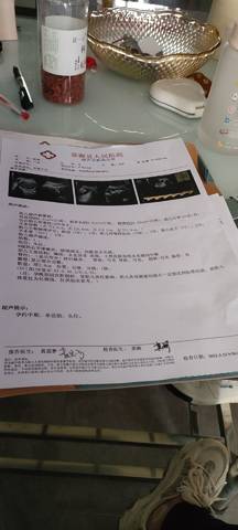 journal_insert_pic_1741143627