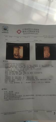 journal_insert_pic_1679821060