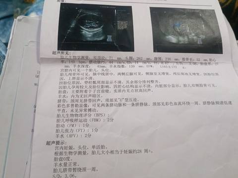 journal_insert_pic_1687539538