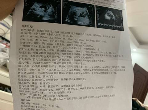 journal_insert_pic_1679991608