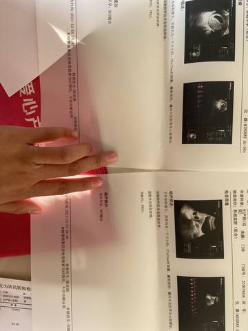 journal_insert_pic_1688357041