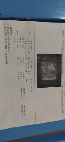 journal_insert_pic_1741037161