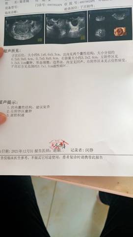 journal_insert_pic_1689571288